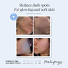 LilyAna Naturals Vitamin C Serum for Face with Hyaluronic Acid and Vitamin E Anti Aging Serum Reduces Age Spots and Sun