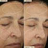 Farmacy 10 Vitamin C Face Serum Waterless Vitamin C Skin Care Serum to Brighten Firm Smooth Skin Texture Enriched with U