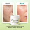 Ongaro Beauty Organic Face Moisturizer Hydrating Face Cream Probiotic Moisturizer with Aloe Vera Vitamin A C E Hyaluroni