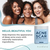 AYADARA Acne Scar Cream 2 fl oz Moisturizing Face Body Cream for Face Stretch Acne Marks Hydrating Formula for All Skin