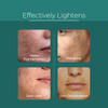 Pure Cimple Probiotic Skin Brightening Serum Dark Spot Face Treatment Age Spots Melasma Sun Damage and Dark Pigmentation
