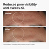 The Ordinary Niacinamide 10 Zinc 1 Smoothing Serum for BlemishProne Skin 1 Fl Oz