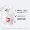 IT Cosmetics Bye Bye Breakout Acne Treatment Face Serum With 2 Salicylic Acid 3 Lactic Acid Helps Reduce Pimples in 3 Da