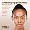 Ambi Even Clear Advanced Fade Cream Hydroquinonefree Hyperpigmentation Treatment Stubborn Dark Spot Corrector Results In
