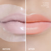 STARSKIN Dreamkiss 2x5g Hydrating Plumping BioCellulose Lip Mask Anti Wrinkle Patches for Lip Evens Fine Lines Wrinkles