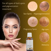 Luxury Swiss Dark Spot Remover for Face Body Serum Gel Cream anti Age Sun Brown anti Spot Acne Freckles Corrector Melasm