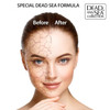 Dead Sea Collection Serum for Face with 5 Hyaluronic Acid Dead Sea Minerals and Vitamin E Anti Aging Nourishing Skin Car