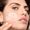 VICHY Normaderm Acne Control Daily Moisturizer Oil Free Acne Moisturizer For Face Max Strength 2 Salicylic Acid Hyaluron