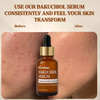 Terrafique Bakuchiol Serum Retinol Alternative Hydrating and Moisturizing Can be Used on Sensitive Skin Anti Aging Also
