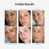 MAREE Face Moisturizer Retinol Cream for Face Daily Wrinkle Cream for Women AntiAging Face Cream Facial Moisturizer with