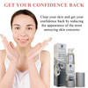 Blemish Spot Treatment Cream Gentle Serum for Redness and Breakouts for Face Back and Body Revive Your Confidence with C