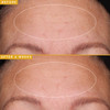 Farmacy Hyaluronic Acid Serum for Face Filling Good Face Serum with Vegan Collagen Peptides Helps Smooth Fine Lines Wrin