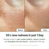 NATURAL DERMA PROJECT NDP Cica Cream Gel Face Moisturizer for Sunburn Relief lightweight Korean Moisturizer for Sensitiv