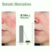 BLITHE Patting Splash Mask Face Exfoliator with Soothing Healing Green Tea Lactic Acid Exfoliating Face Wash for Acne Pr