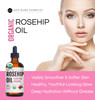 Kate Blanc Cosmetics Rosehip Oil for Face Softer Glowing Skin 1oz Organic 100 Pure Cold Pressed Rosehip Seed Face Oil fo