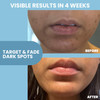 Niacinamide 12 Serum for Face wZinc Hyaluronic Acid Vitamin B3 E Pore Minimizer for Dark Spot Corrector Even Skin Tone O