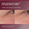 Dermalogica Dynamic Skin Retinol Facial Serum with MultiRetinoid Complex Retexturizing and Improving Skin Health 1 fl oz
