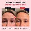 Eclat Skincare Retinol Night Cream Renewing Retinol Cream for Face with Hyaluronic Acid Anti Aging to Smooth Wrinkles Fi