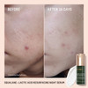 Biossance Squalane Lactic Acid Resurfacing Night Serum Vegan 10 Lactic Acid Face Serum for Skin Texture and Fine Lines G
