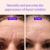 BLUMBODY Face Forehead Wrinkle Patches Mini AntiWrinkle Facial Patches for Eyes Mouth Forehead Triangle NonSilicone Face
