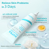 ZealSea 10 Azelaic Acid Facial Cream Azelaic Acid Serum with Niacianmide Pionin for Face Relief Pimple Breakouts Blackhe