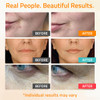 YEOUTH Skin Care Set Retinol Serum for Face Vitamin C and Hyaluronic Acid Face Serum Facial Skincare Serums that Targets