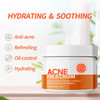 Acne Cream Pimple Cream for Face Oil Control Pimple Remover Cream Get Rid of Pimples Fastfor Oily and Acne Prone Skin Cr