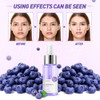 Blueberry Face Serum Sodium Hyaluronic Acid Pure Skin Care Moisturizing Essence for Daily Care Skin Repair Brightening S