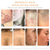 Face Body Clearing Serum Level 1 for acne folliculitis aging skin ingrown hairs dark spots face chest butt back thighs a