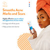 AcneFree Retinol Blemish Mark Resurfacing Serum with Hyaluronic Acid and Niacinamide Helps to Reduce the Appearance of A