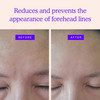 Blumbody Forehead Wrinkle Patches Anti Wrinkle Facial Patches to Smooth Eyes Forehead Wrinkles NonSilicone Face Tape for