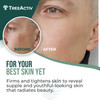 TreeActiv Retinol Cream 2 oz Retinol Cream for Face and Body Gentle Retinol Moisturizer with Hyaluronic Acid Moisturing