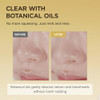 SKIN1004 Madagascar Centella Light Cleansing Oil 676 floz 200ml Gentle Oil Cleanser for Face Korean Facial Cleanser Doub