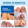 Toenail Fungus Treatment Extra Strength Nail Fungus Treatment for Toenail Fungal Nail Repair Pen 4 Packs