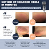 Electric Callus Remover Rechargeable Electronic Foot File CR900 by Own HarmonyTested Most Powerful Best Pedicure Tools w