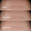Clinique Smart Skin School Supplies Smooth Renew Lab Gift Set Smart Clinical Repair Wrinkle Correcting Cream Face Serum