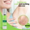 Organic Ingrown Hair and Razor Burn Serum 2 Pack for Men and Women Exfoliating AHA for Smooth Skin After Shaving Waxing
