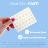 MEDca Acne Patches for Face Hydrocolloid Bandages 36 Count Pimple Patches for Face in 2 Universal Sizes Acne Spot Treatm