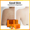 Koji Acid Soap for Dark Spots Turmeric Soap for Face and Body Kojic Acid Soap Skin Brightening Tumeric Soap for Acne Dar
