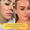 KOA LIFE VitC Illuminating Facial Cleanser Vitamin C Facial Wash Skin Illuminating Face Wash Gentle Foam Cleanser Vegan
