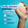 Dermisa Sulfur Bar Soap with Aloe Vera Helps to Cleanse Oily AcneProne Skin and Unclog Pores Contains Sulfur Aloe Vera N
