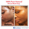 Raw African Liquid Black Soap 32 oz 100 Natural soap for Acne Eczema Psoriasis and Dry Skin Scar Removal Face And Body W
