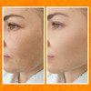 Bee and You Vitamin C Face Serum Moisturizing Anti Aging Reduce the Appearance of Dark Spots Glow Up Skin Brightener wit