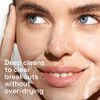 Cetaphil Acne Face Wash Gentle Clear Clarifying Acne Cream Cleanser with 2 Salicylic Acid Deep Cleans Treats Acne Prone