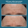Lancer Skincare The Method Cleanse Face Cleanser Daily Face Wash with Salicylic Acid Normal or Combination Skin 405 Flui