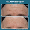 Lancer Skincare The Method Cleanse Face Cleanser Daily Face Wash with Salicylic Acid Oily or Congested Skin 405 Fluid Ou