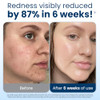 Clean Skin Club Clean Towels XL 100 USDA Biobased Face Towel Disposable Face Towelette Eczema Association Accepted Makeu