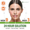 Acne Face Cream Acne Spot Treatment for Face Acne Dots Tea Tree Oil Salicylic Acid Natural Cystic Acne Treatment Made in