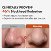 Hanskin BHA Pore Cleansing Oil Gentle Blackhead Cleanser and Makeup Remover for Combination and Oily Skin Korean Skincar
