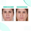 Serious Skincare Glycolic Cleanser Daily NonDrying Exfoliating Face Wash 10 Glycolic Acid Deep Pore Purifying Removes Bl